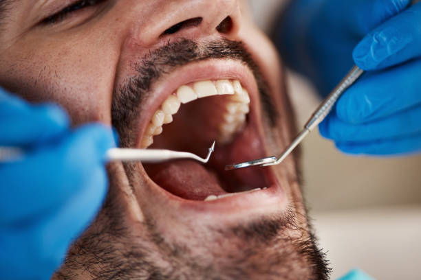Best Emergency Dentist for Special Needs Patients in Mahomet, IL
